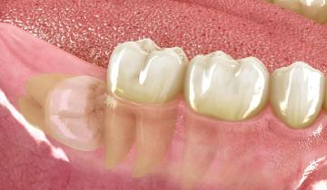 Dentista cirugía oral