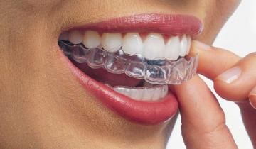 Dentista ortodoncia transparente