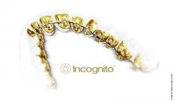 Dentista ortodoncia lingual