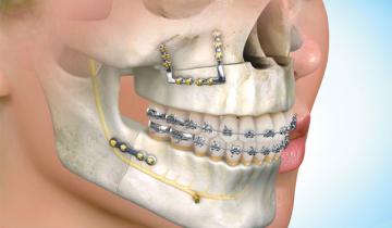 Dentista ortodoncia y cirugía ortognática