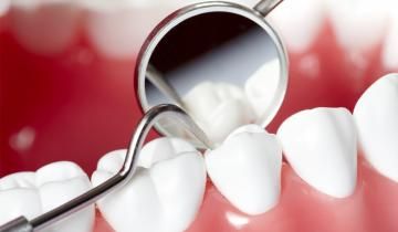 Dentista periodoncia